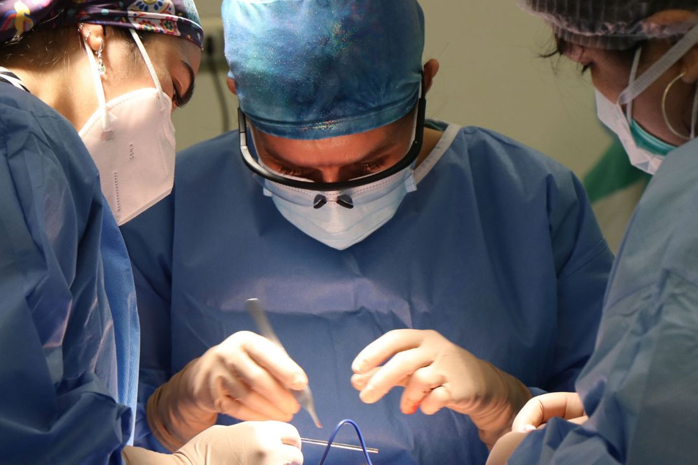 فیلم عمل جراحی فنستریشن اراکنویید کیست بطن 3 به روش اندوسکوپیک اپی لپسی